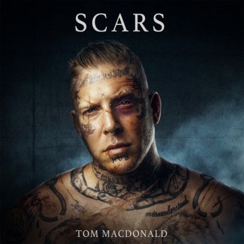 Tom MacDonald Scars