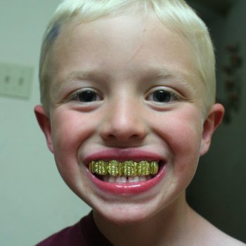 Grillz Spacy Moody