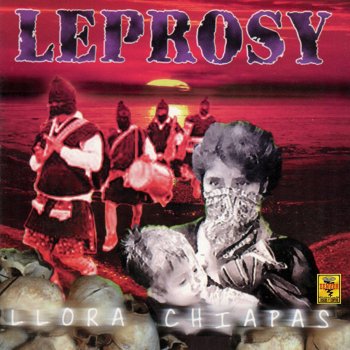 Leprosy Llora Chiapas