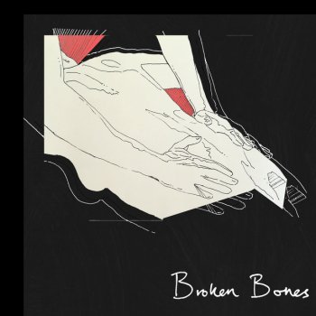 Tors Broken Bones