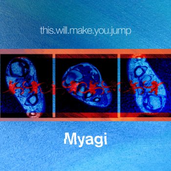 Myagi Warehouse Bounce (Dislexik Remix)