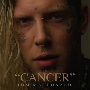 Tom MacDonald Cancer