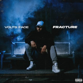 Volts Face Fracture