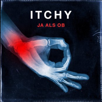 ITCHY Unser Lied