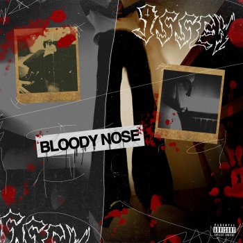 9ssey bloody nose