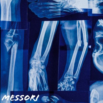 Исполнитель Messori, альбом Broken Bones