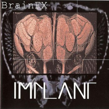 Implant My Sin (Neurotic)