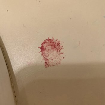 (too generic) blood