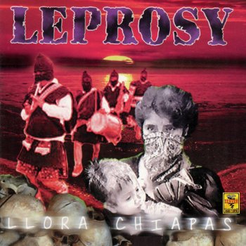 Leprosy Cuba Libre