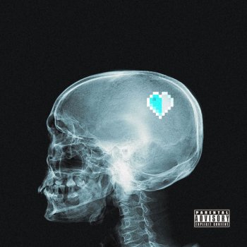 Prettyheartbreak On My Brain
