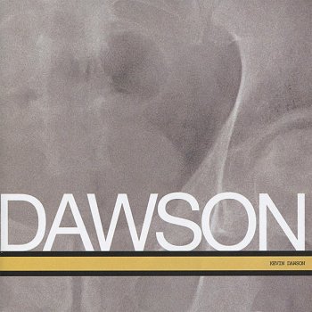 Dawson Candlelight