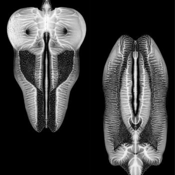 The Skull Defekts Pattern of Thoughts