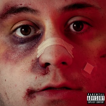Billy Marchiafava lost boy