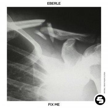 Eberle Fix Me